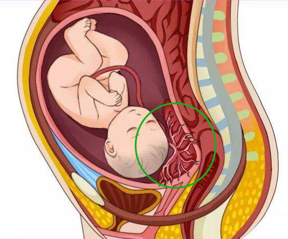 前置胎盘临床表现图片图片